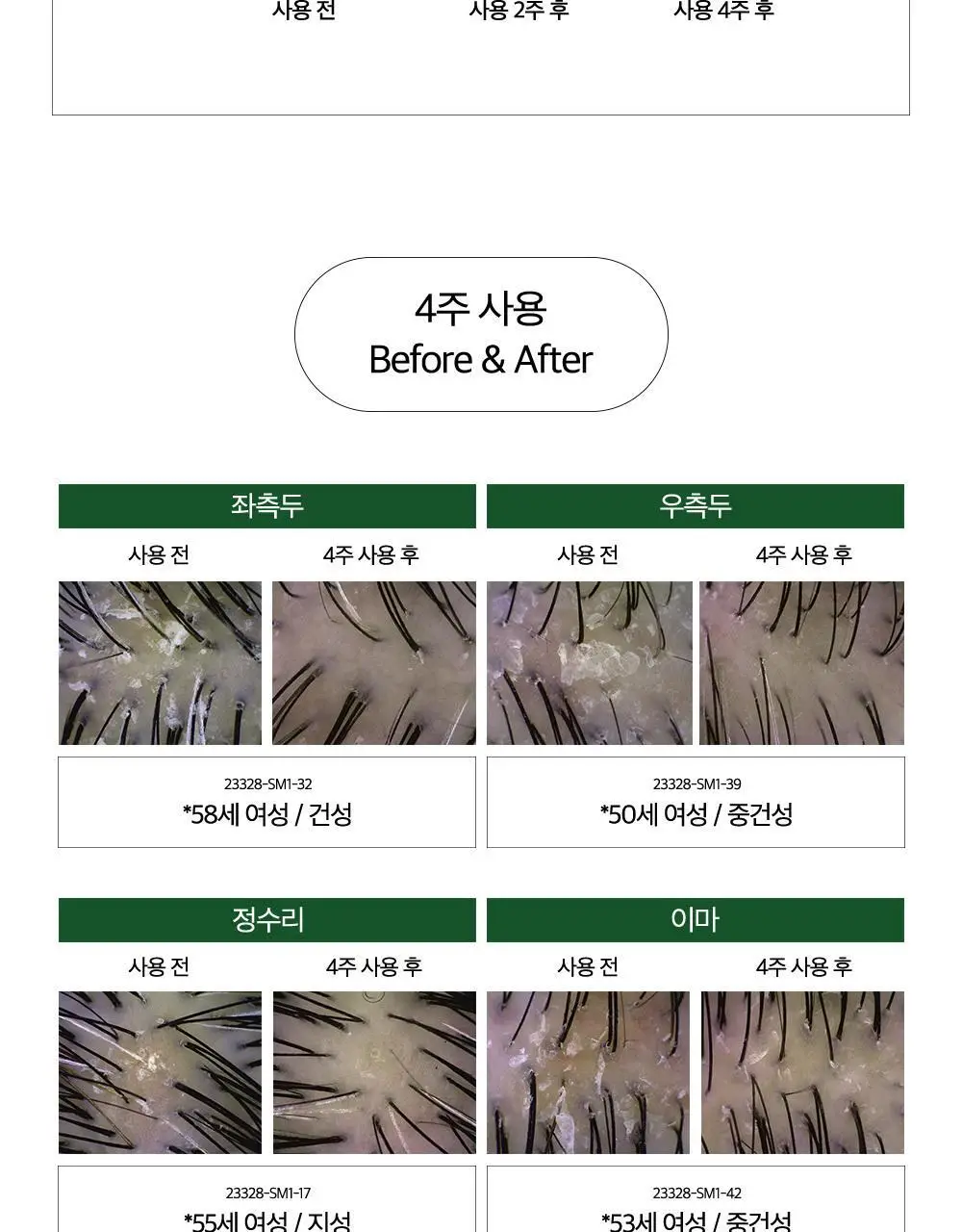 [대용량] CKD 아미노 비오틴 두피 각질 샴푸 750ml 상세페이지 9